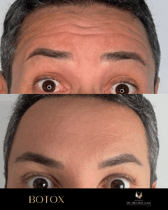 harmonização facial florianópolis